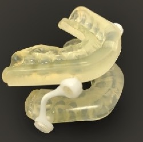 Orthèse d'avancée mandibulaire